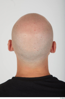  Photos Efrain Fields bald head 0005.jpg